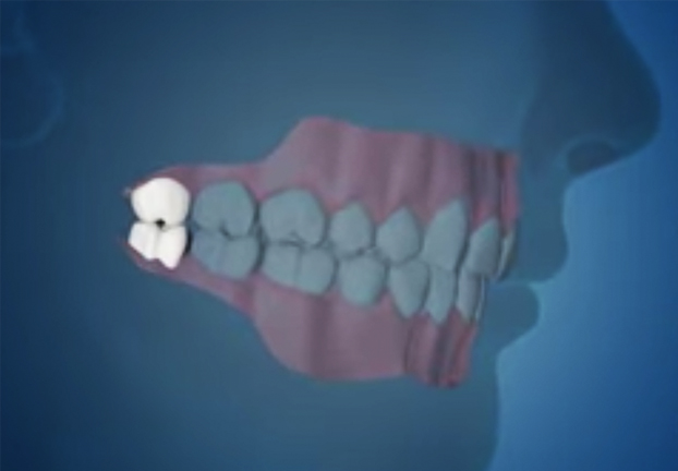 Denta care1